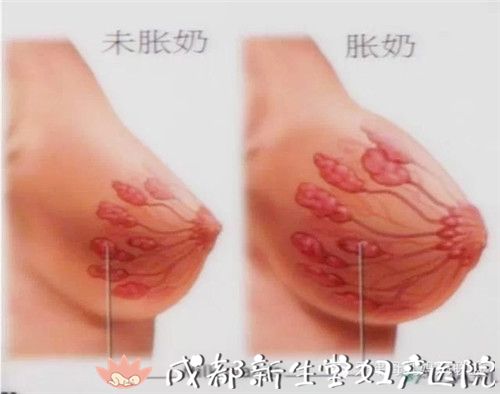 有一种痛叫产后涨奶