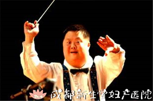 唐氏综合征患者舟舟
