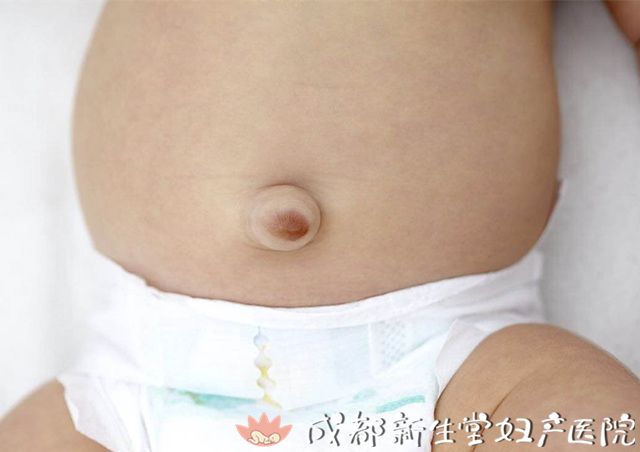 成都妇产医院,成都高水平的产科医院,成都专业的妇产医院,新生堂妇产医院，成都顺产医院，瘢痕子宫，母乳喂养，侧切 ，婴儿脐疝