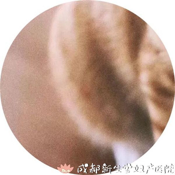 医院,成都顺产医院,瘢痕子宫顺产医院,母乳喂养高的医院,侧切低的医院