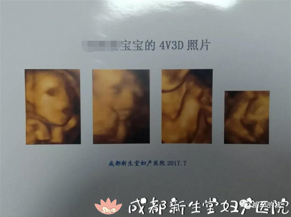 成都妇产医院,成都高水平的产科医院,成都专业的妇产医院,新生堂妇产医院，成都顺产医院，瘢痕子宫顺产医院，母乳喂养高的医院，侧切低的医院