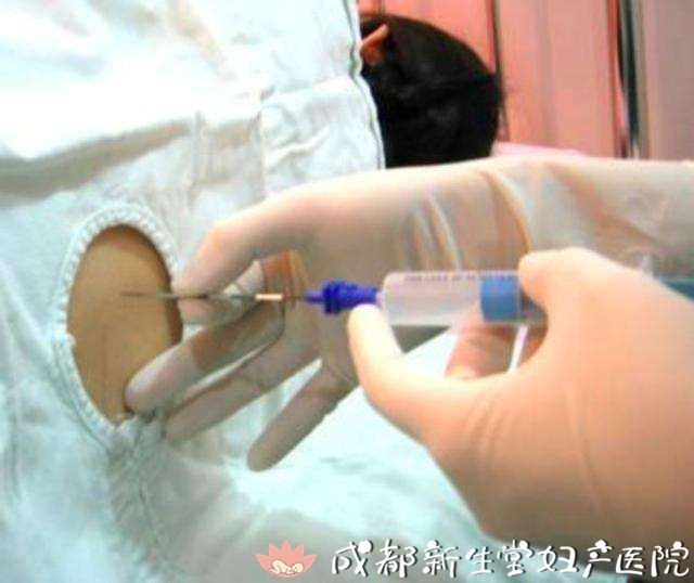 成都专业的妇产医院,新生堂妇产医院,成都顺产医院,瘢痕子宫顺产医院