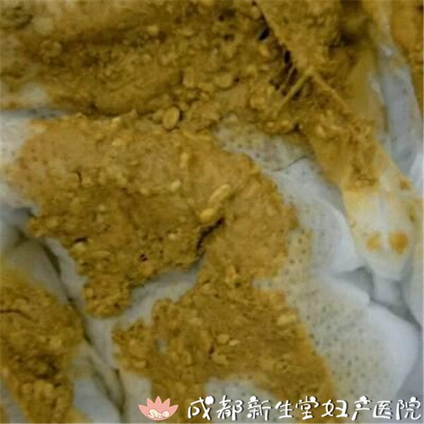 胆道梗阻时胆汁不能排泌进肠道,肠道内缺乏胆汁以及其转化成的粪胆原