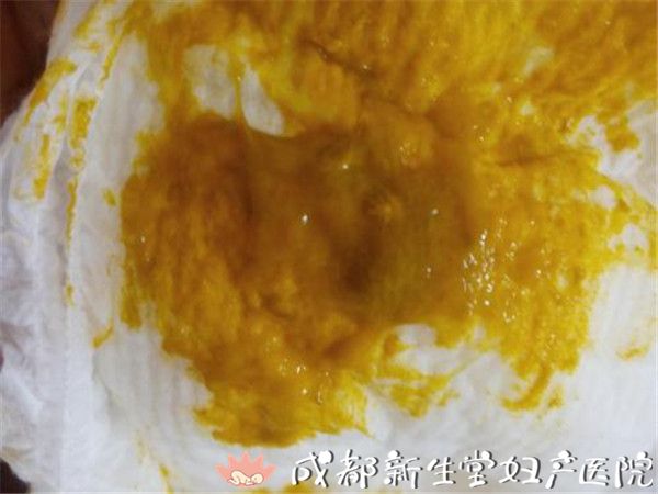 尤其是宝宝有腹胀,腹痛以及呕吐,血便等情况时要及时查大便常规,看看