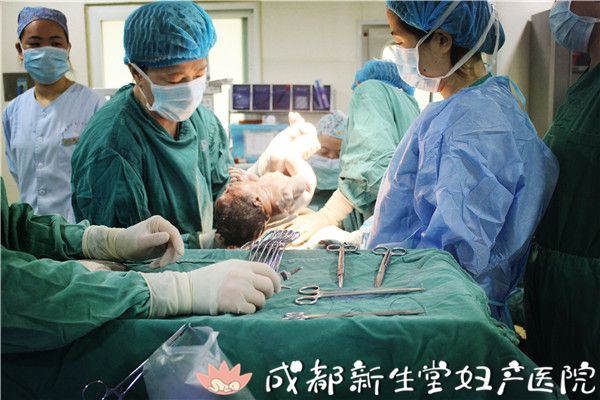 成都妇产医院,成都高水平的产科医院,成都专业的妇产医院,新生堂妇产医院，成都顺产医院，瘢痕子宫，母乳喂养，侧切 ，剖腹产