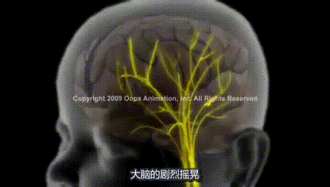 1岁宝宝成脑瘫！这些要命的哄娃招式你可能天天在做！