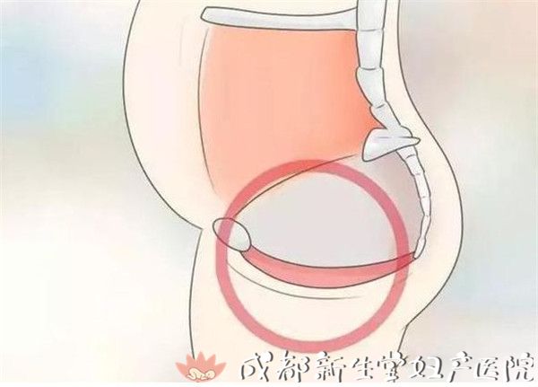 ella长文自曝生完儿子膀胱子宫脱垂尿失禁两年不得不做手术